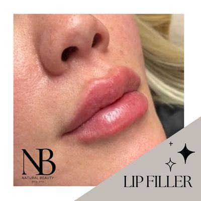 Performed by our master injector, Kristen Kelly, get the natural and plump lips you've desired!