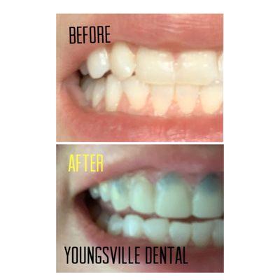 Youngsville Dental Care