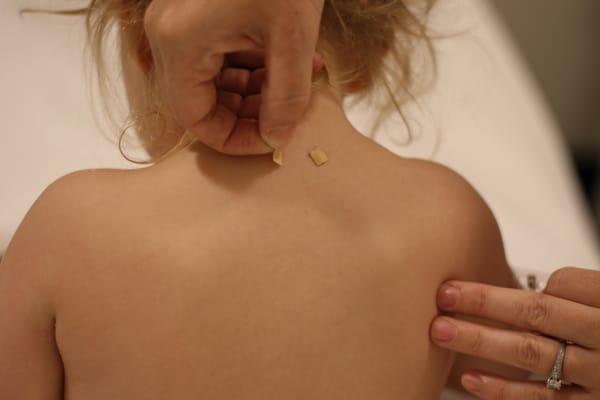 No needle pediatric treatments