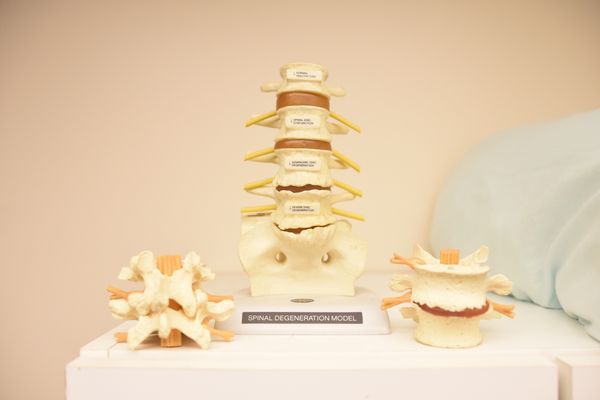 Spinal degeneration model