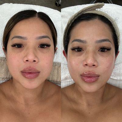 Biologique Recherche Remodeling Facial by Michelle