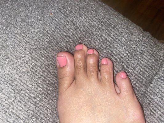 Horrible pedicure