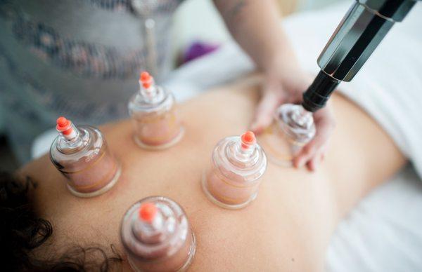 Cupping (acupressure) adds healing to your massage!