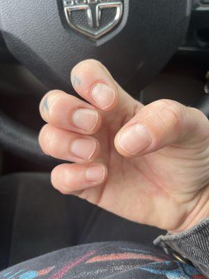 Bad "manicure"