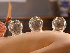 Cupping Therapy