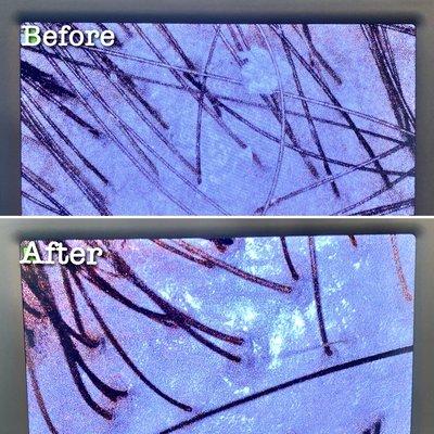 After: Shiny, decongested scalp from the healthy removal of buildup that can lead to hair loss & irritation.