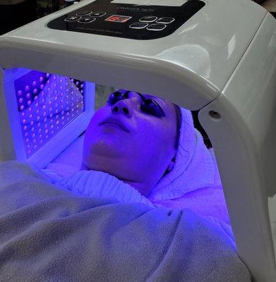 Teen Acne LED Facial