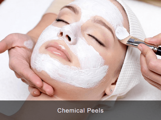 Chemical Peels