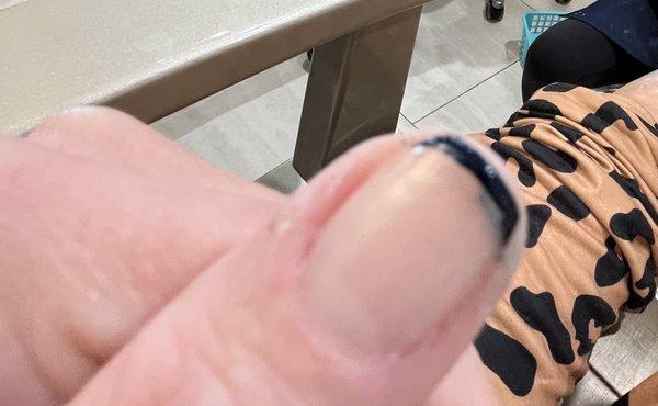 Thumb Nail with an extra side of polish underneath it