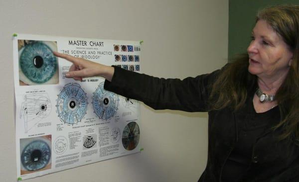 Carlene is going over the chart for Iridology