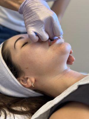 buccal massage THE FACE Costa Mesa