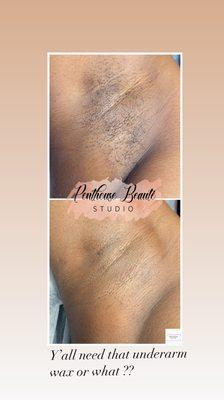 Underarm Wax