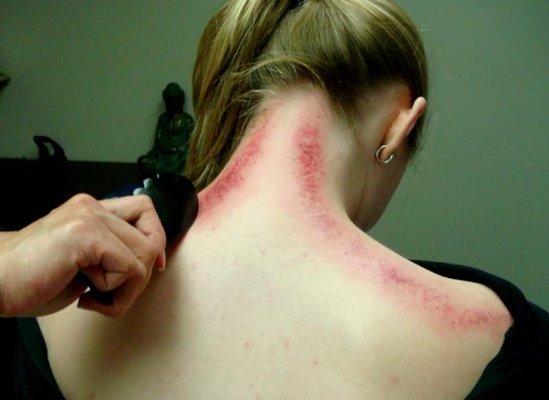 Gua Sha is a great way to reduce inflammation.