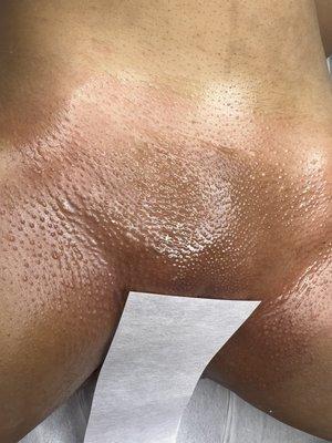 Full Brazilian Wax