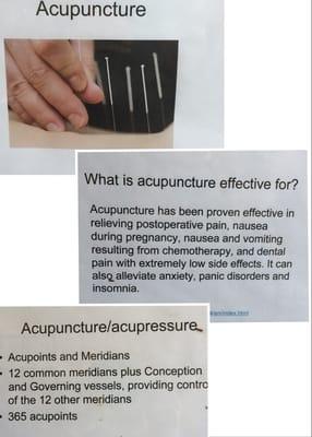 The Theory of Acupuncture