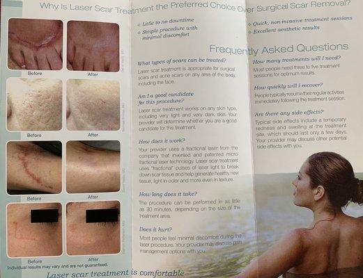 Brochure of fractional laser