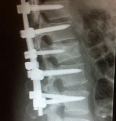 Got a few screws.