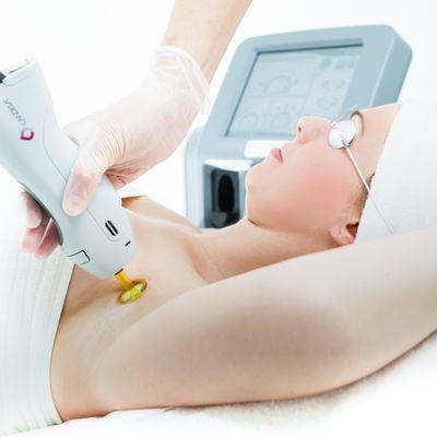 Women's Laser Hair Removal for the undersrams. Takes less than 5 minutes!