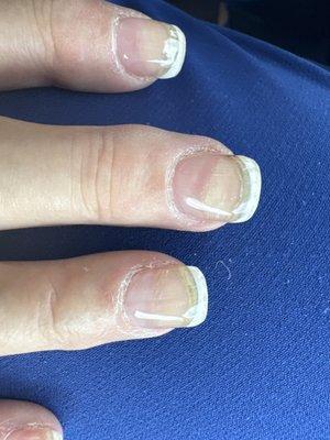 Horrible nail fill