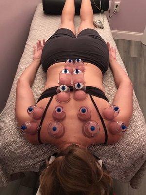 You have to try this amazing cupping technique!