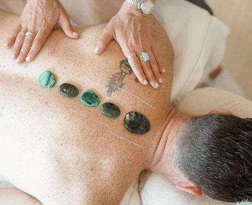 Acupuncture with Crystal Therapy