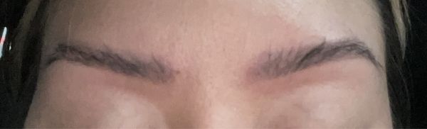 Eyebrows immediately after laser removal! Such a fast process! I'm so happy already!