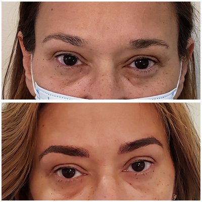 Microblading before and after