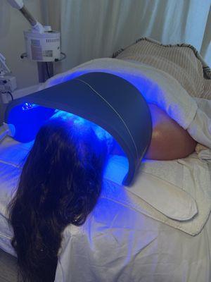 Blue LED for Acne and Inflammation