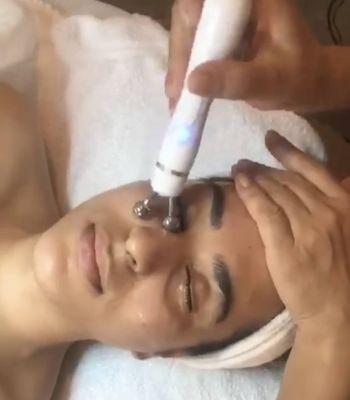 Hydrafacial