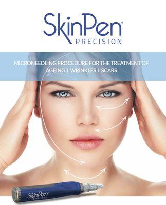 SkinPen Microneedling boosts collagen and improves acne scars