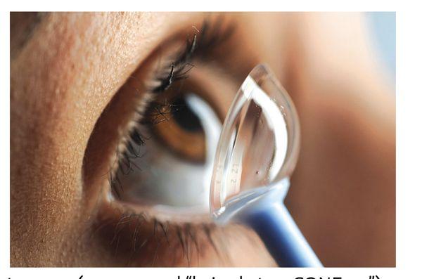 Dr Wang enjoys fitting specialty contact lens patients including keratoconus scleral lenses.