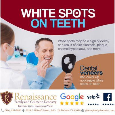 White Spots on Teeth? They might be a sign of decay or could result from factors like diet, fluorosis, plaque, or enamel hypoplasia.