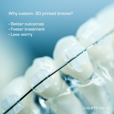 Proud to offer custom clear braces