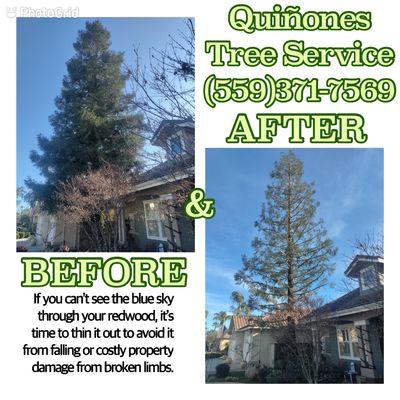 Before & After Redwood trimming