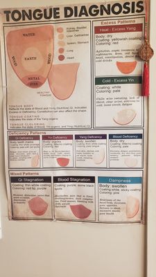 Tongue Diagnosis - seems impossible but thinking about the western medicine practices you believe.