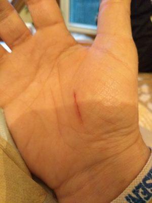 My first cut to blood by faulty instalation  that Sears refuses to refund or repair/ Do Not Hire Them /I Lost $27000!!!!!