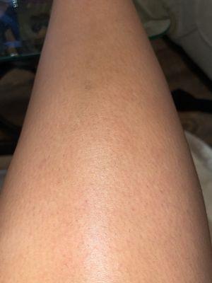 This is my shin post wax. Not greasy, sticky. Little to no redness from fresh wax. Truly is a god sent product!