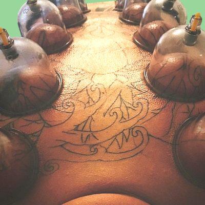 Aloha touch massage in Boise offers cupping therapy.