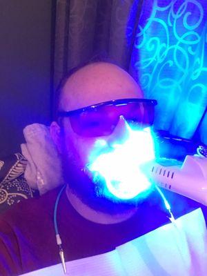 Getting my teeth whitened.