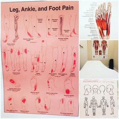 Leg, Ankle & Foot Pain