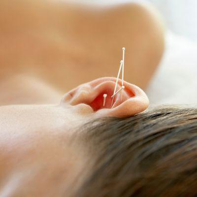 Acupuncture on ear points helps with allergies, stress, and more!