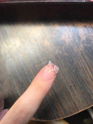 My nail with ointment on it