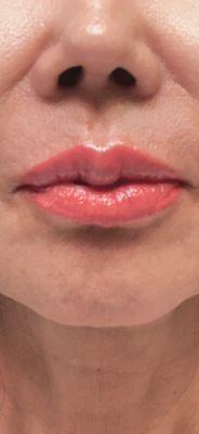 Lips blushing.