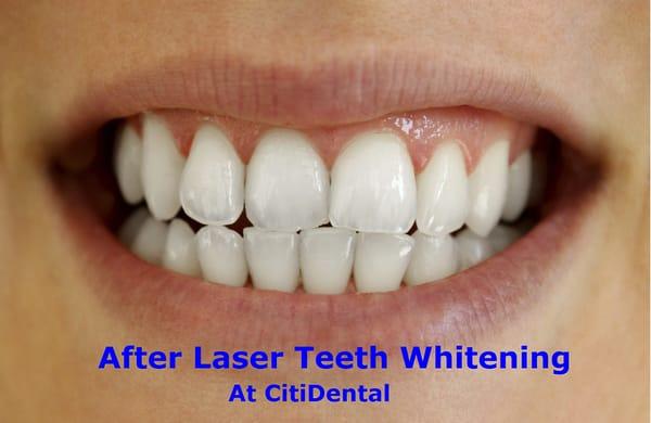 The results of whitening