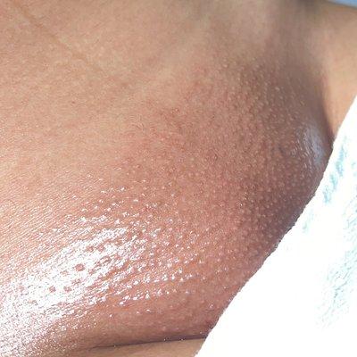 Full brazilian wax