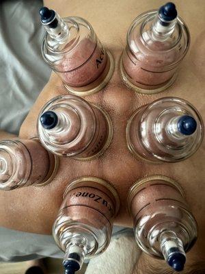 Cupping