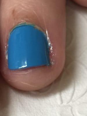 Notice the cuticle still on my nail (white cuticle on the left)