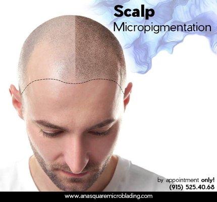 New service for men and women!!! Scalp micropigmentation