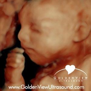 3d ultrasound with hd live at 30 weeks