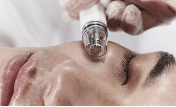 Hydro facial diamond tip dermabrasion .. buffer away dull dead skin declog pores. Suitable for all types.